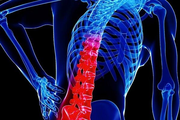 Le ragioni dello sviluppo del toraxosteocondosi