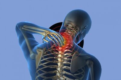 Dolore al collo con osteocondosi